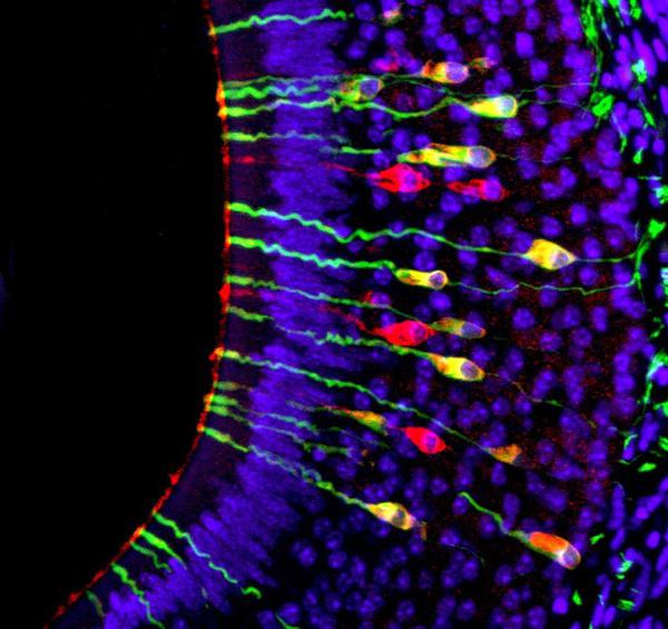 Neurons that detect disease